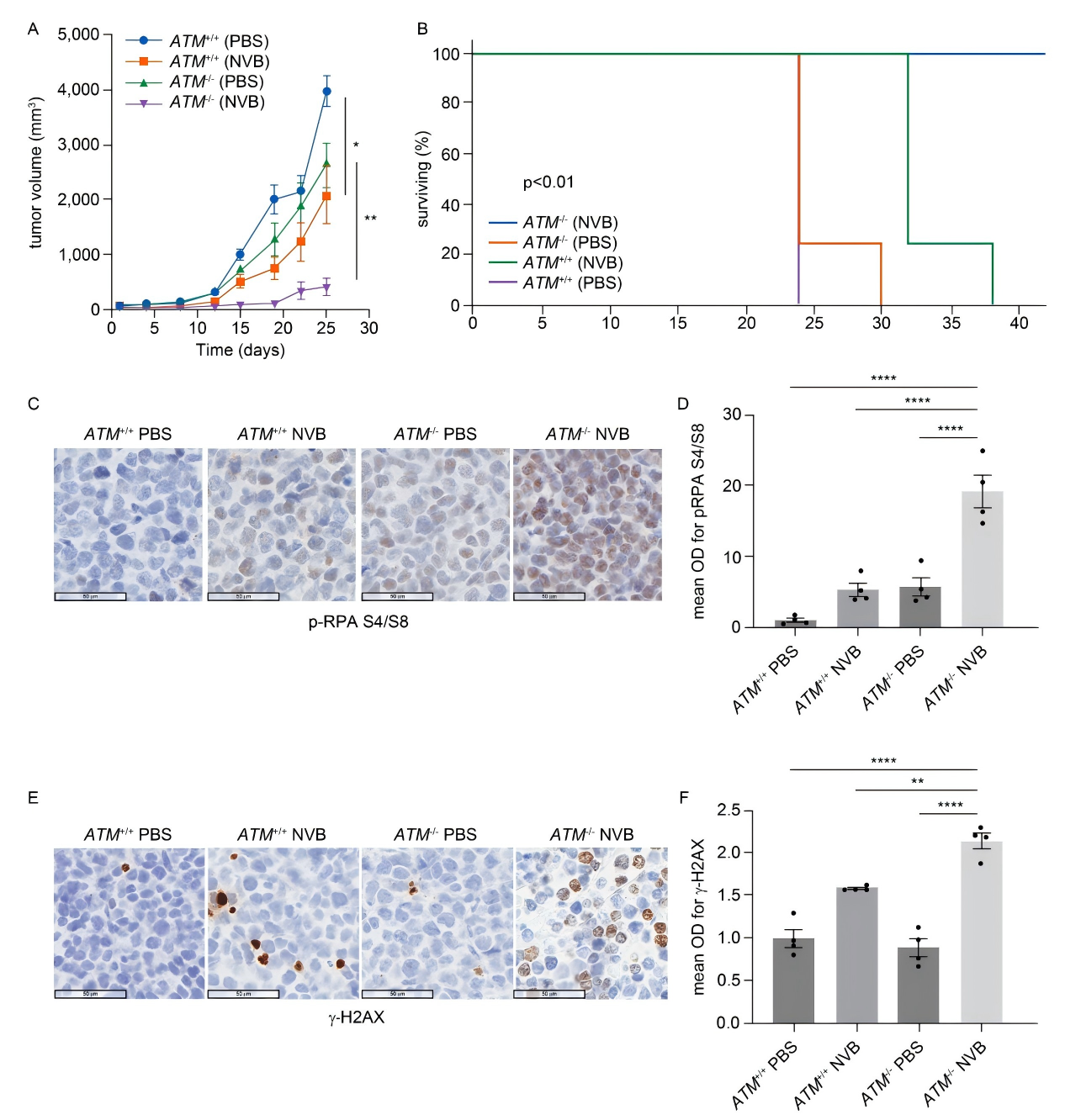 Antitumor effect of POLθ inhibition in an in vivo MCL model