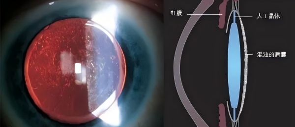 汕头博德眼科医院