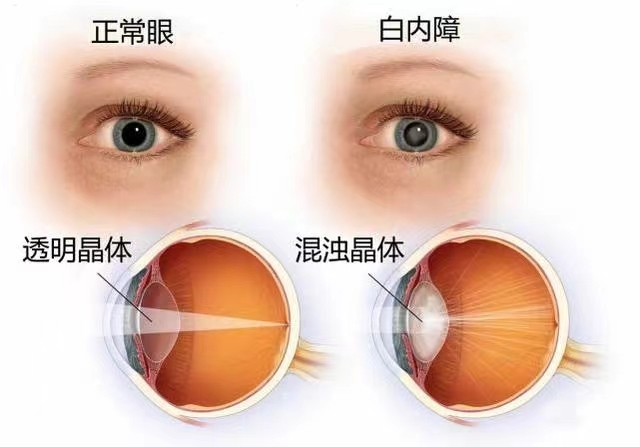 汕头博德眼科医院