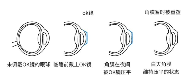 汕头博德眼科医院