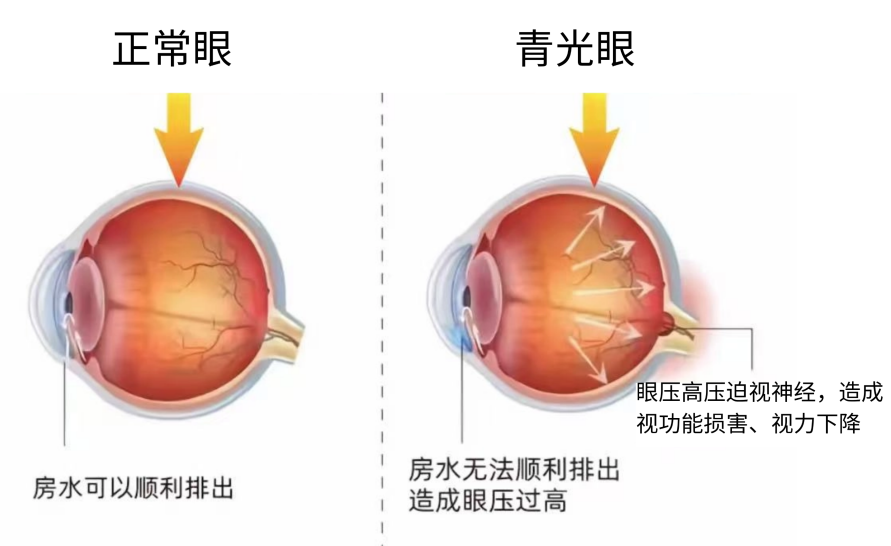 汕头博德眼科医院