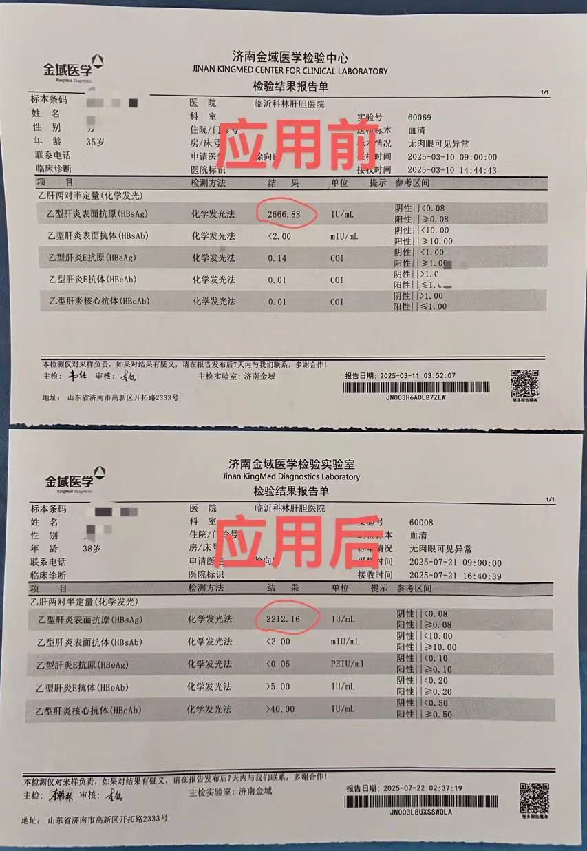 表3   HBsAg降低.jpg