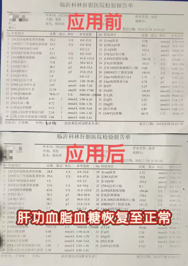 表7   肝功血脂血糖恢复正常.jpg