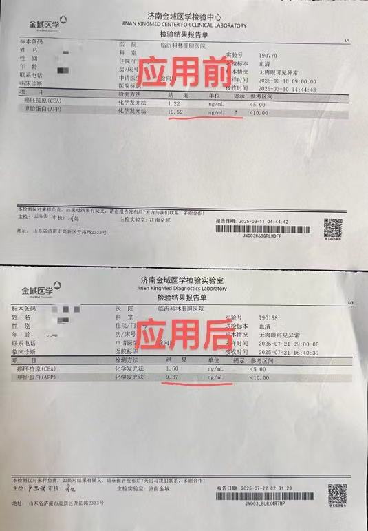 表5  AFP降至正常.jpg