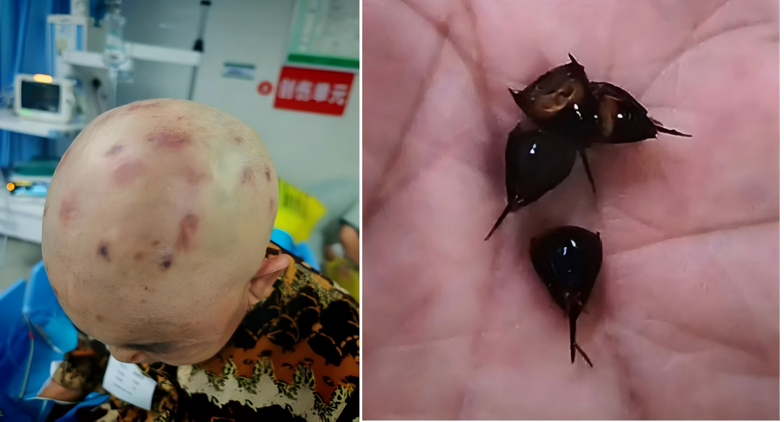 马蜂.png